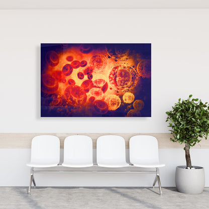 Medical Office Art - Infected blood cells - Einrichtungsbeispiel Foto
