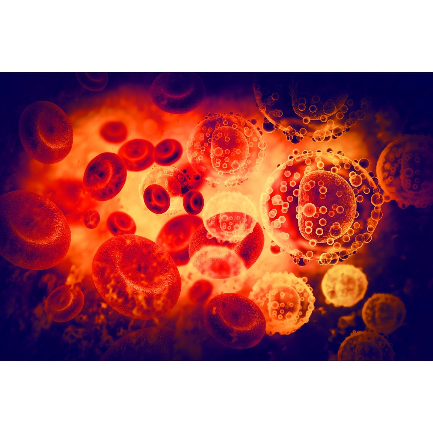 Medical Office Art - Infected blood cells